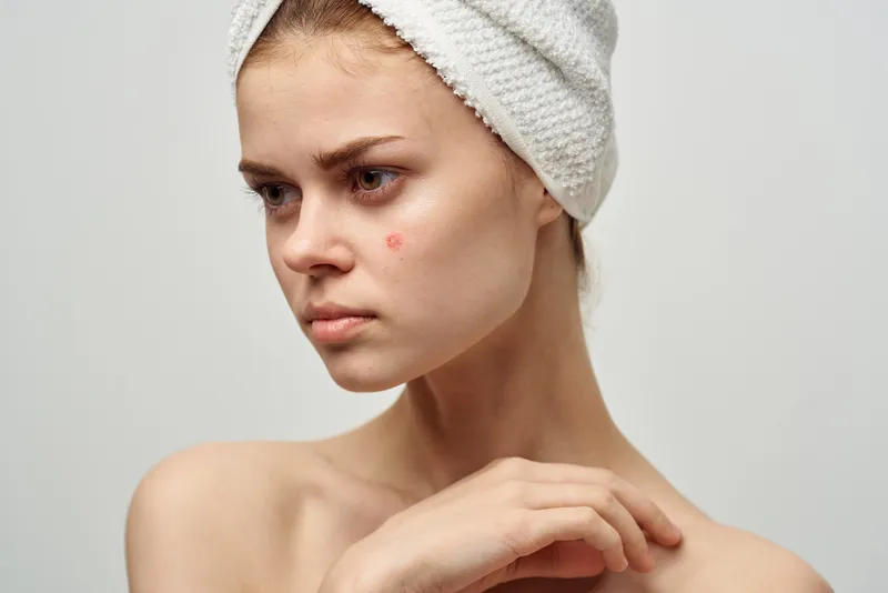 Красивая женщина с полотенцем на голове, изолированный фон, дерматология