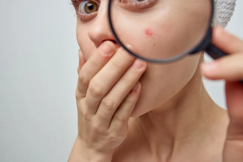 Красивая женщина с увеличительным стеклом в руке в косметологической студии