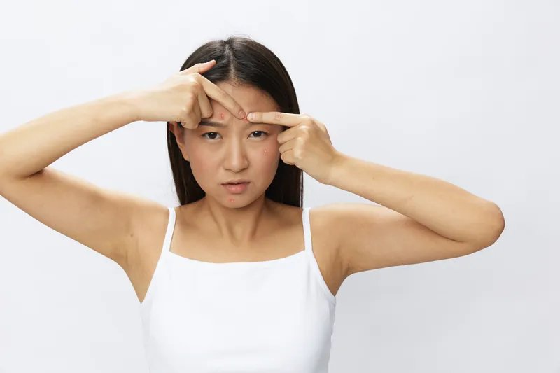 Азиатская женщина с проблемами кожи лица: акне и воспаления, красные высыпания и аллергия, ветряная оспа, грусть из-за сыпи