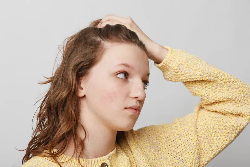Young woman with natural skin and light brown hair touches her head, wearing a yellow sweater. Concept of skincare, natural beauty, and casual lifestyle in studio with neutral background.
