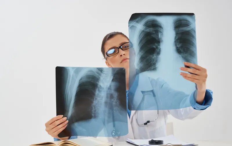 Врач в медицинском халате сидит за столом и изучает рентгеновский снимок