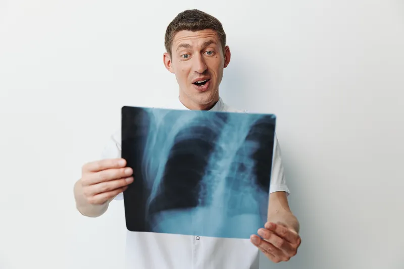 Врач держит рентгеновский снимок легких