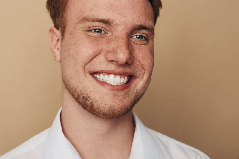 Smiling young man with red hair and freckles shows white teeth in close-up portrait on beige background. Concept of happiness, confidence, natural beauty, and positive emotions.