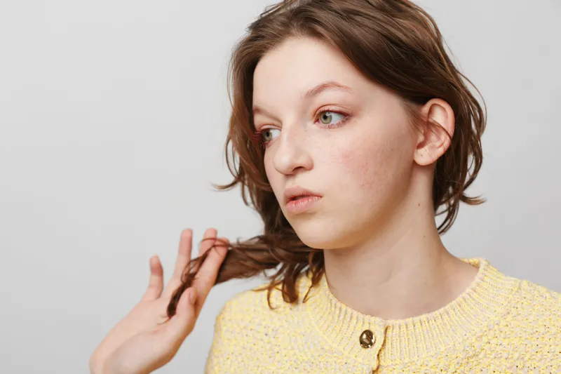 Young woman with acne and red skin looks away while holding her hair. Close-up portrait on light background. Concept of skin condition, natural beauty, and self-awareness.