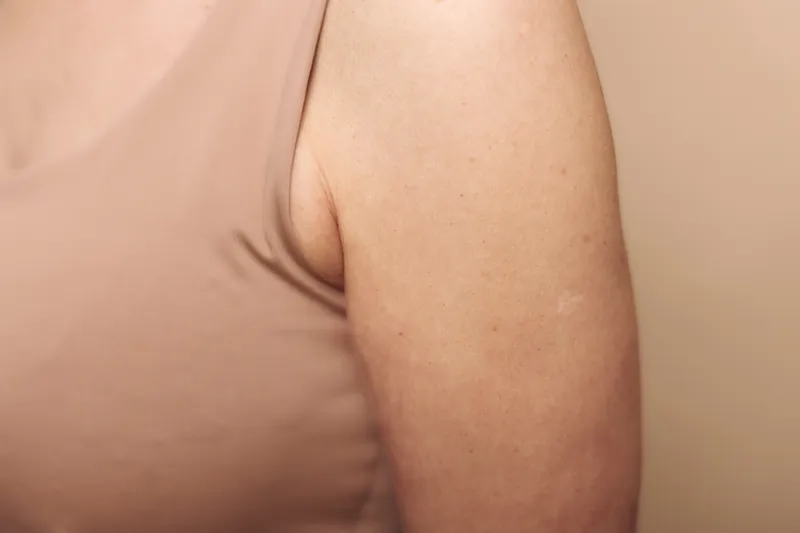 Close-up of a woman’s upper arm and shoulder in a sleeveless beige top against a plain beige background. Concept for skin texture, body care, and natural beauty details.