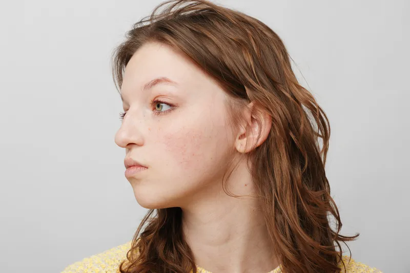 Profile portrait of a young woman with natural skin and brown hair looking sideways against a plain light background. Concept of natural beauty, youth, and casual lifestyle.