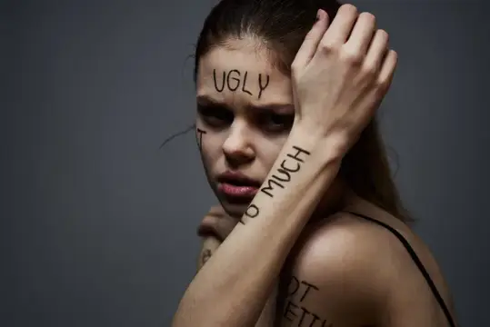 Молодая женщина с надписью UGLY на лбу прикрывает лицо рукой