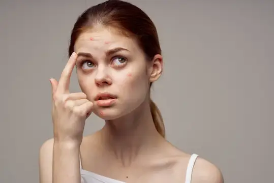 Молодая женщина с высыпаниями на лице рассматривает кожу
