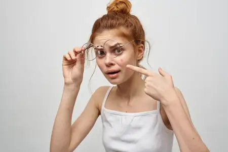 Женщина в белой футболке и очках, на лице у нее прыщи