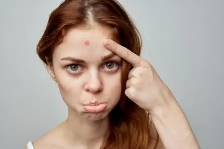 Студийная фотография высокой четкости, на которой изображена симпатичная женщина, сталкивающаяся с проблемами кожи в области косметологии
